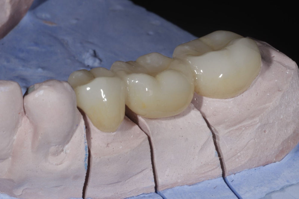 ZIRCONIA
